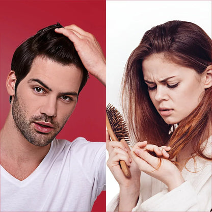 💊 Avalon Pharma Avogain 5% Minoxidil Topical Solution – Hair Regrowth Treatment, 50ml